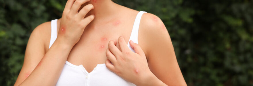 allergie aux moustiques